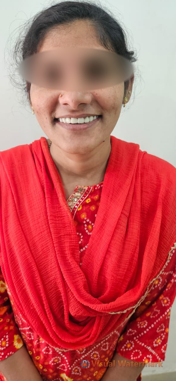 Dental treatment after — patient 16 smile transformation at Durge Dental Mancherial