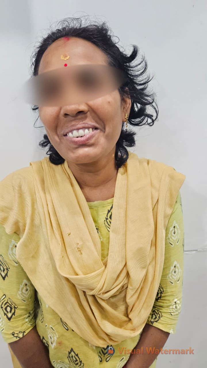 Dental treatment after — patient 8 smile transformation at Durge Dental Mancherial