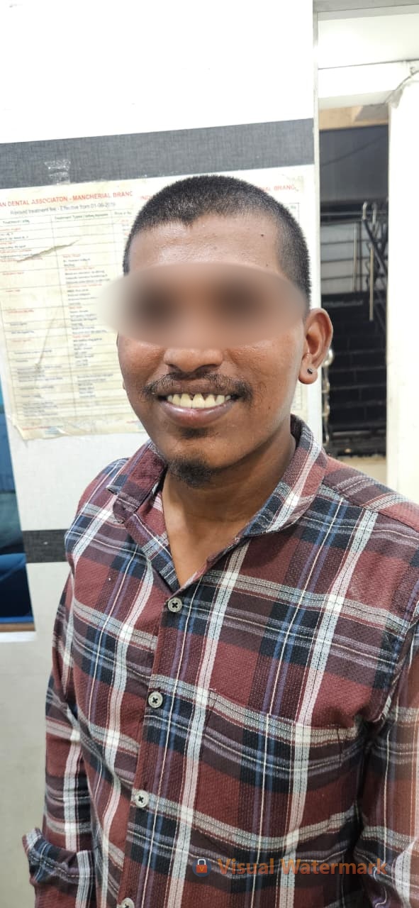 Dental treatment after — patient 9 smile transformation at Durge Dental Mancherial