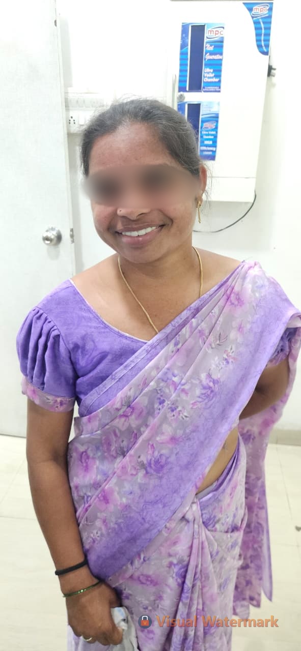 Dental treatment after — patient 10 smile transformation at Durge Dental Mancherial