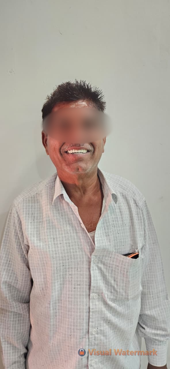 Dental treatment after — patient 15 smile transformation at Durge Dental Mancherial