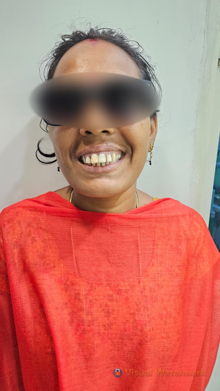 Dental treatment before — patient 8 at Durge Dental Clinic Mancherial