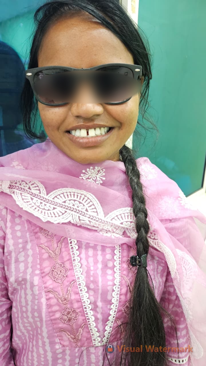 Dental treatment before — patient 11 at Durge Dental Clinic Mancherial
