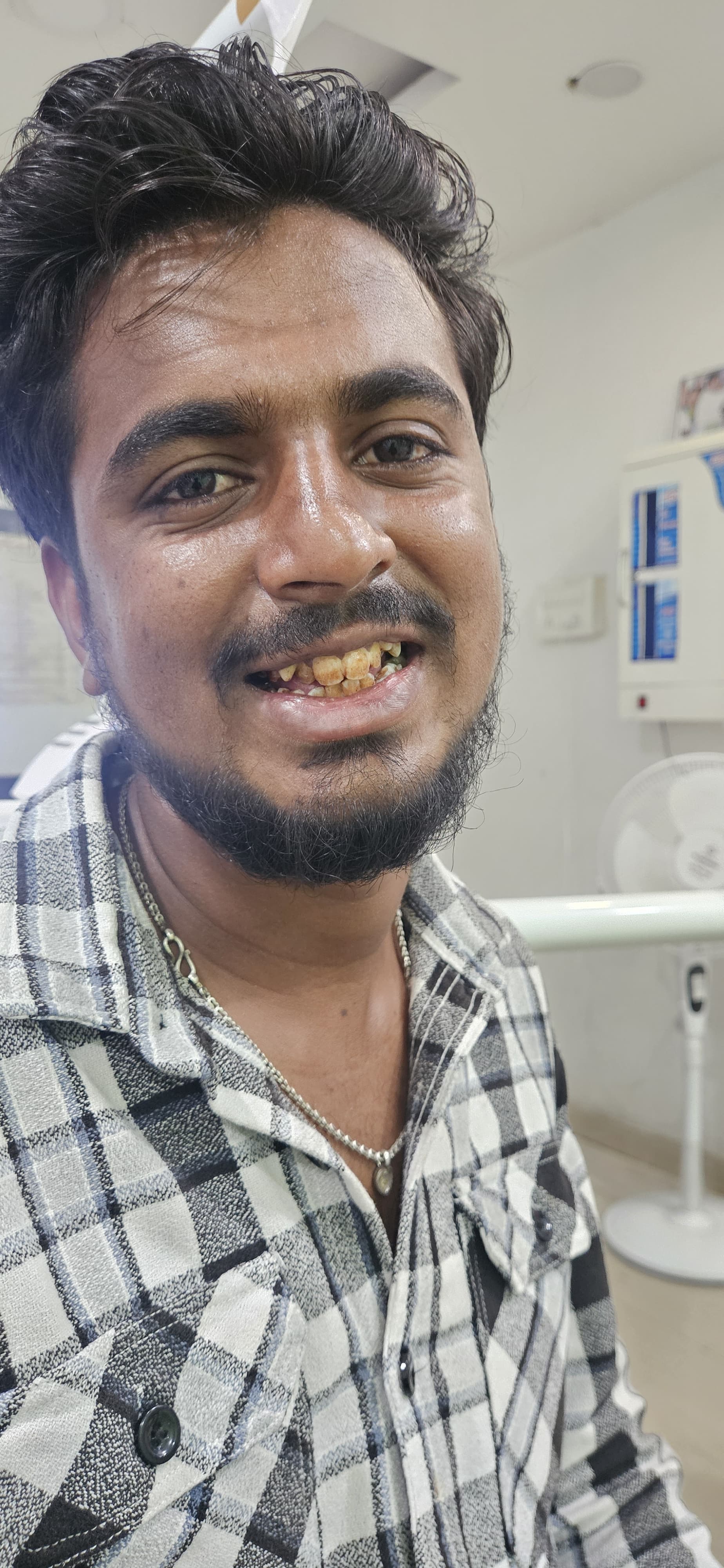 Dental treatment before — patient 5 at Durge Dental Clinic Mancherial