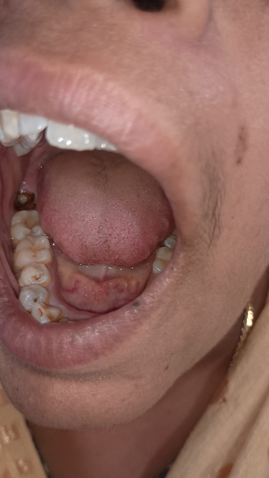 Dental treatment before — patient 7 at Durge Dental Clinic Mancherial
